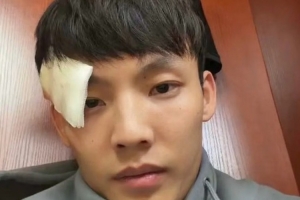 眉骨缝了3针！徐杰晒照：新赛季 为广东而战 兄弟齐心 开门红🔥